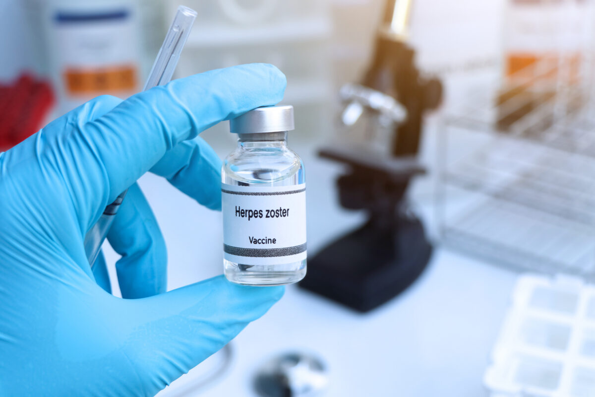 herpes zóster