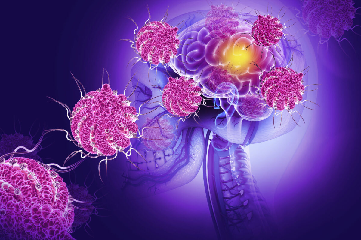 virus Nipah