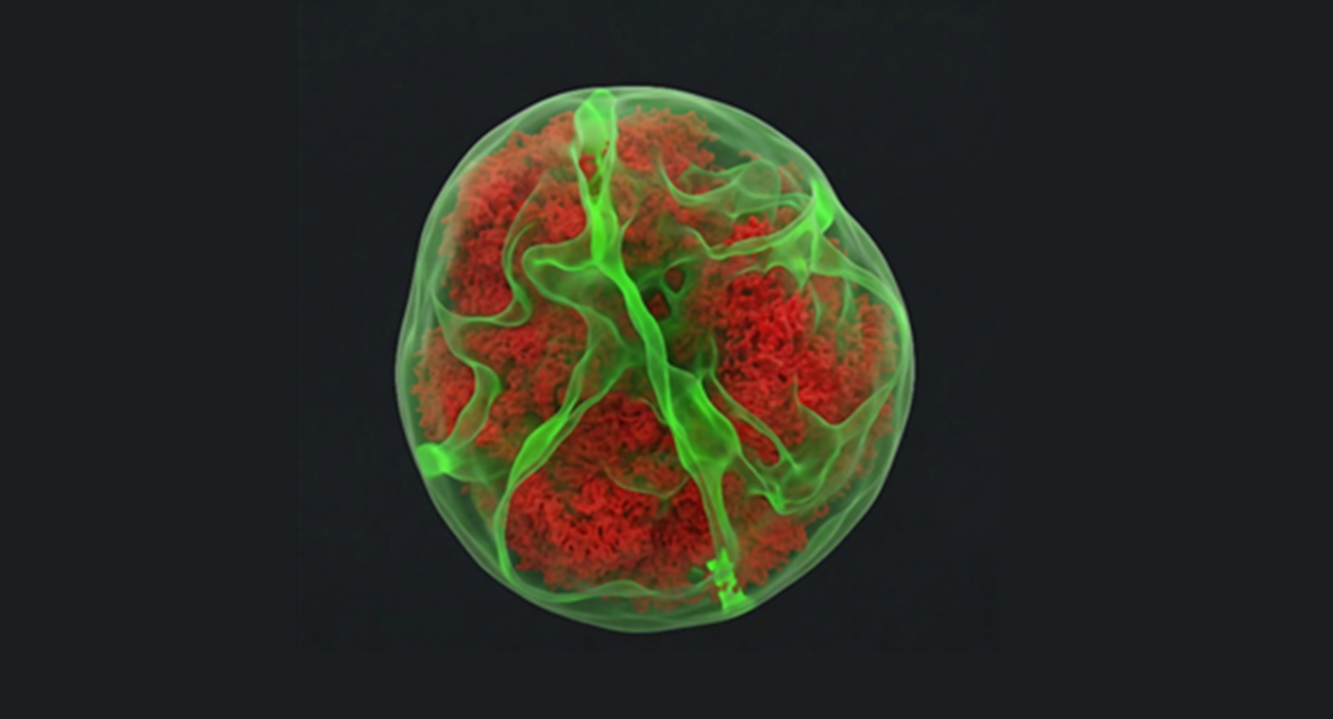 leucemia