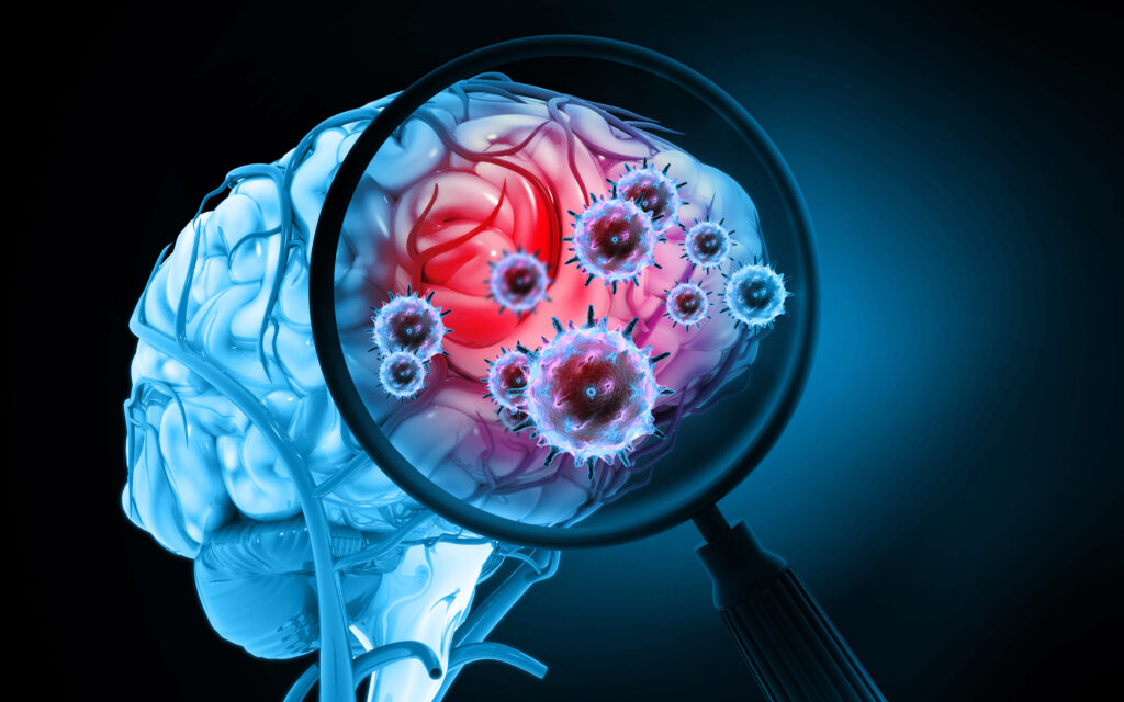 meningitis