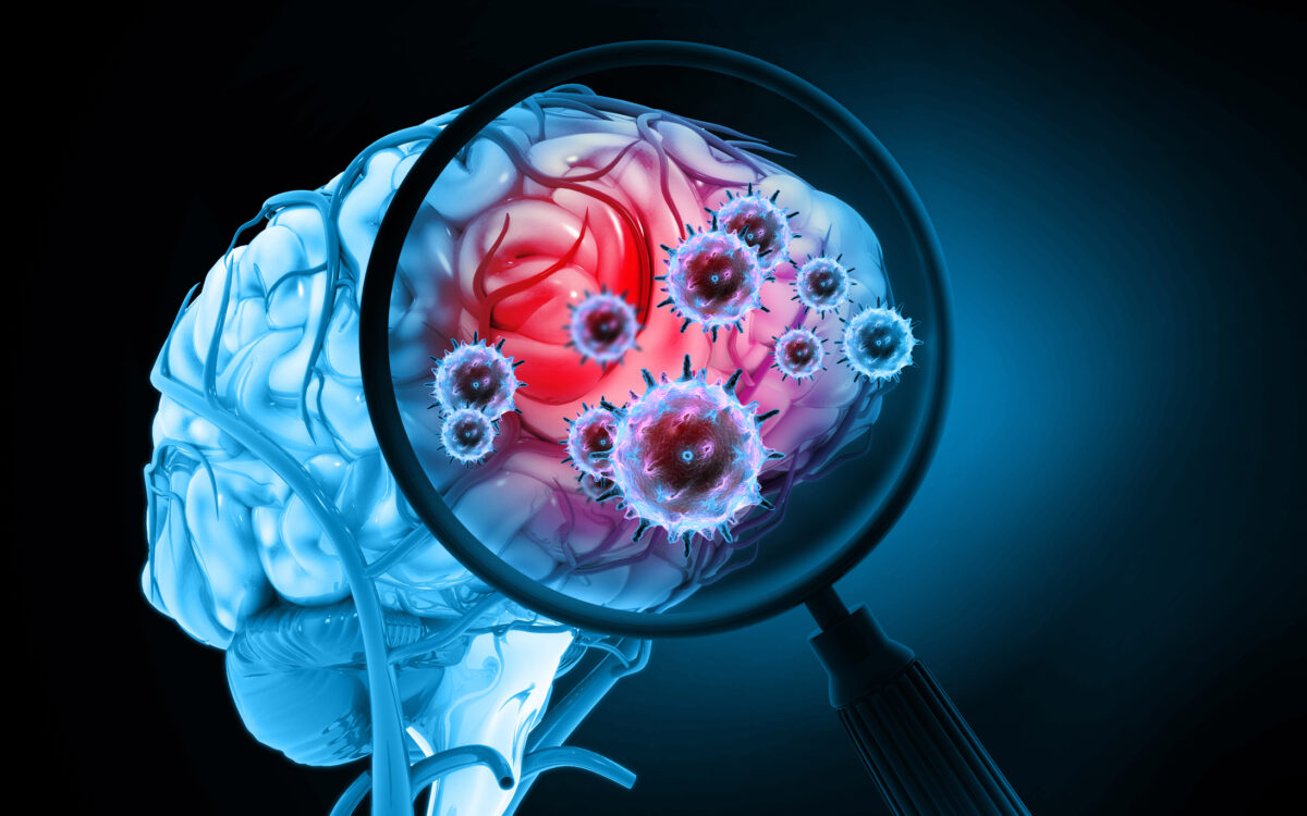 meningitis
