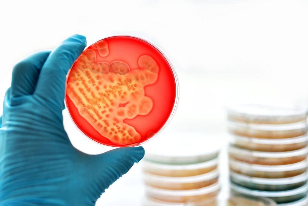 Klebsiella pneumoniae