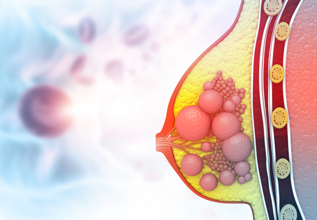 cáncer