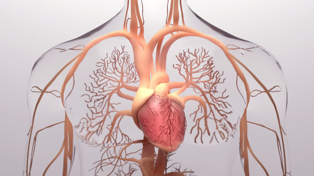 hipertensión pulmonar