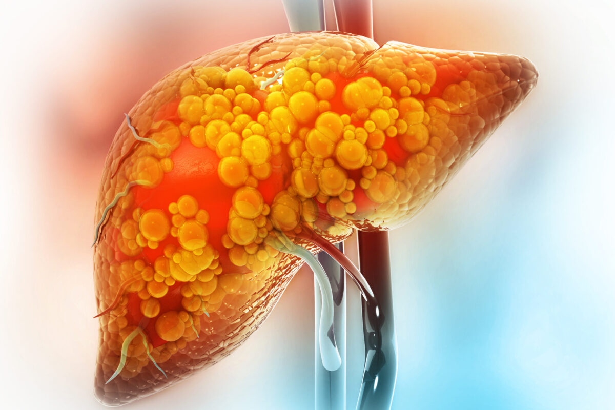 fibrosis hepática