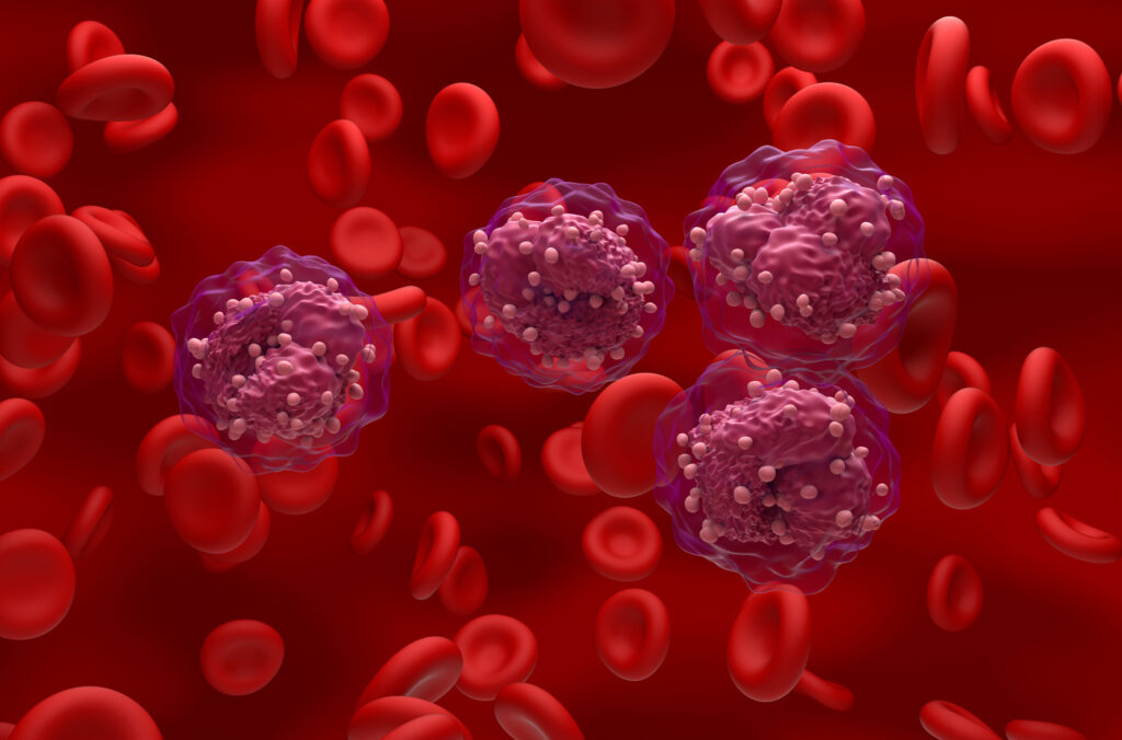 leucemia