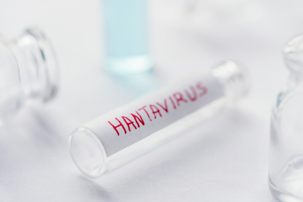hantavirus