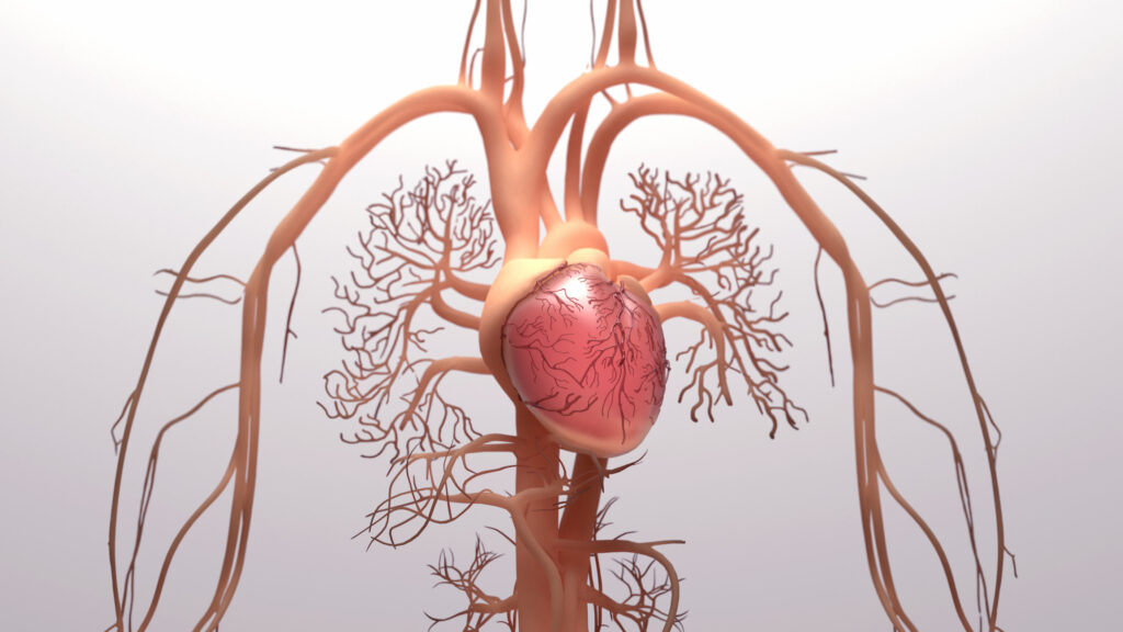 hipertensión arterial pulmonar