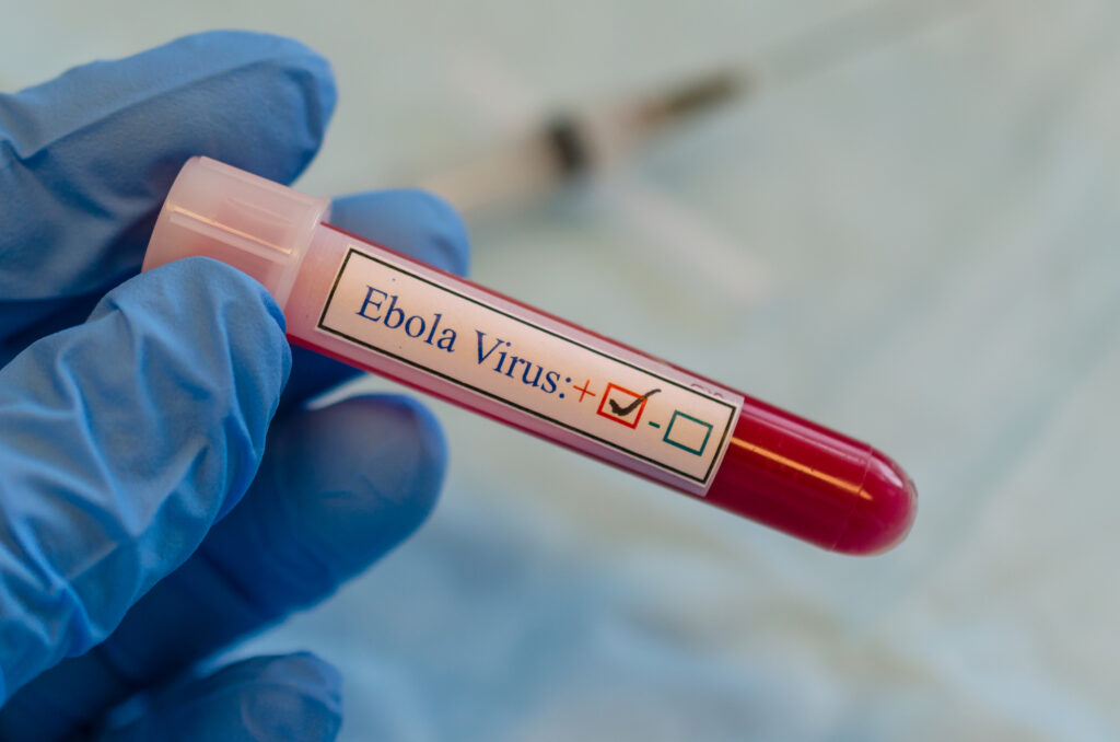 ébola
